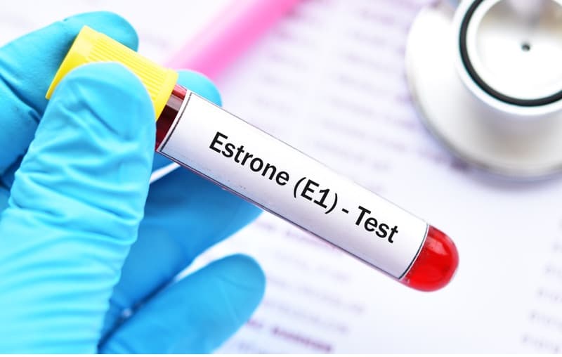 Estramet: esame per la prevenzione del tumore al seno